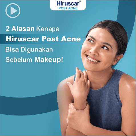 hiruscar post acne
