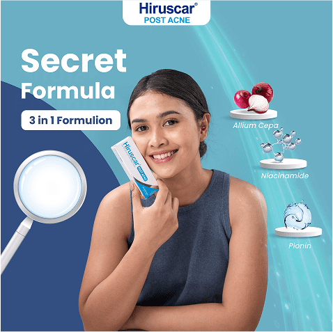 secret formula